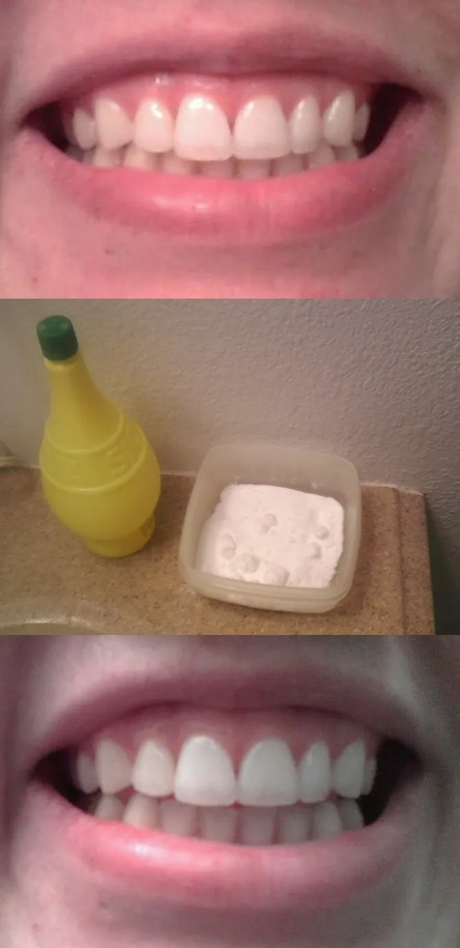 25255 mixing baking soda paste