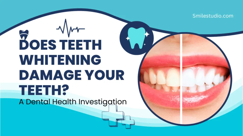 25264 at home teeth whitening
