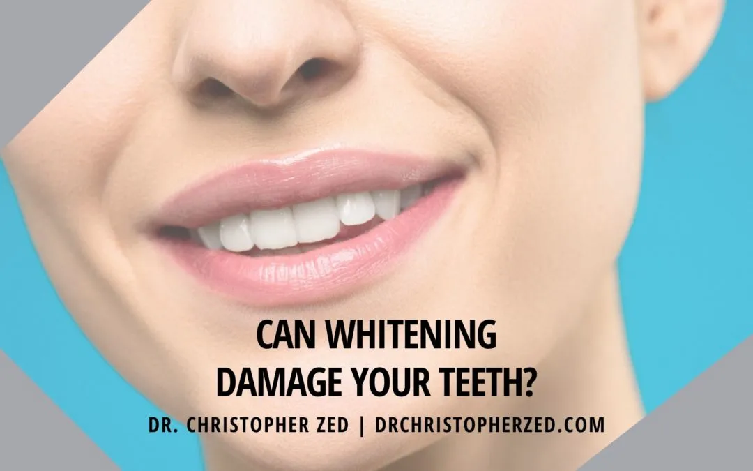 25264 teeth whitening aftercare