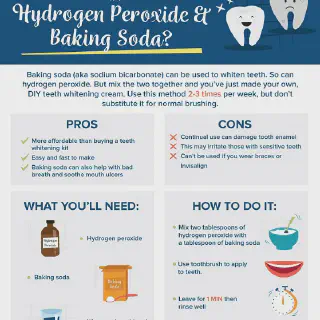 /img/25267-professional-teeth-whitening.webp