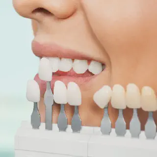 /img/25279-hydrogen-peroxide-teeth-whitening-7.webp