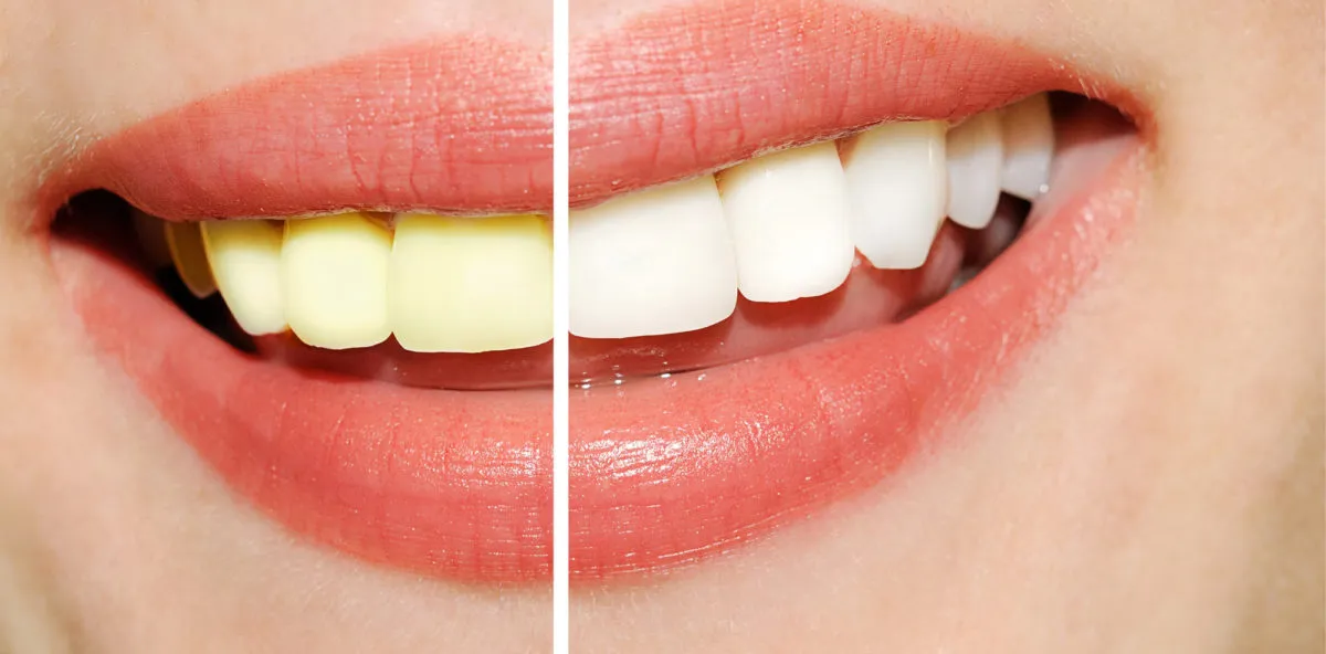 25281 avoid staining foods