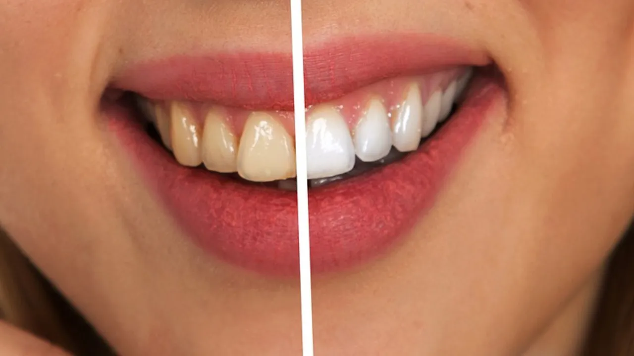 /img/25281-maintaining-white-smile.webp