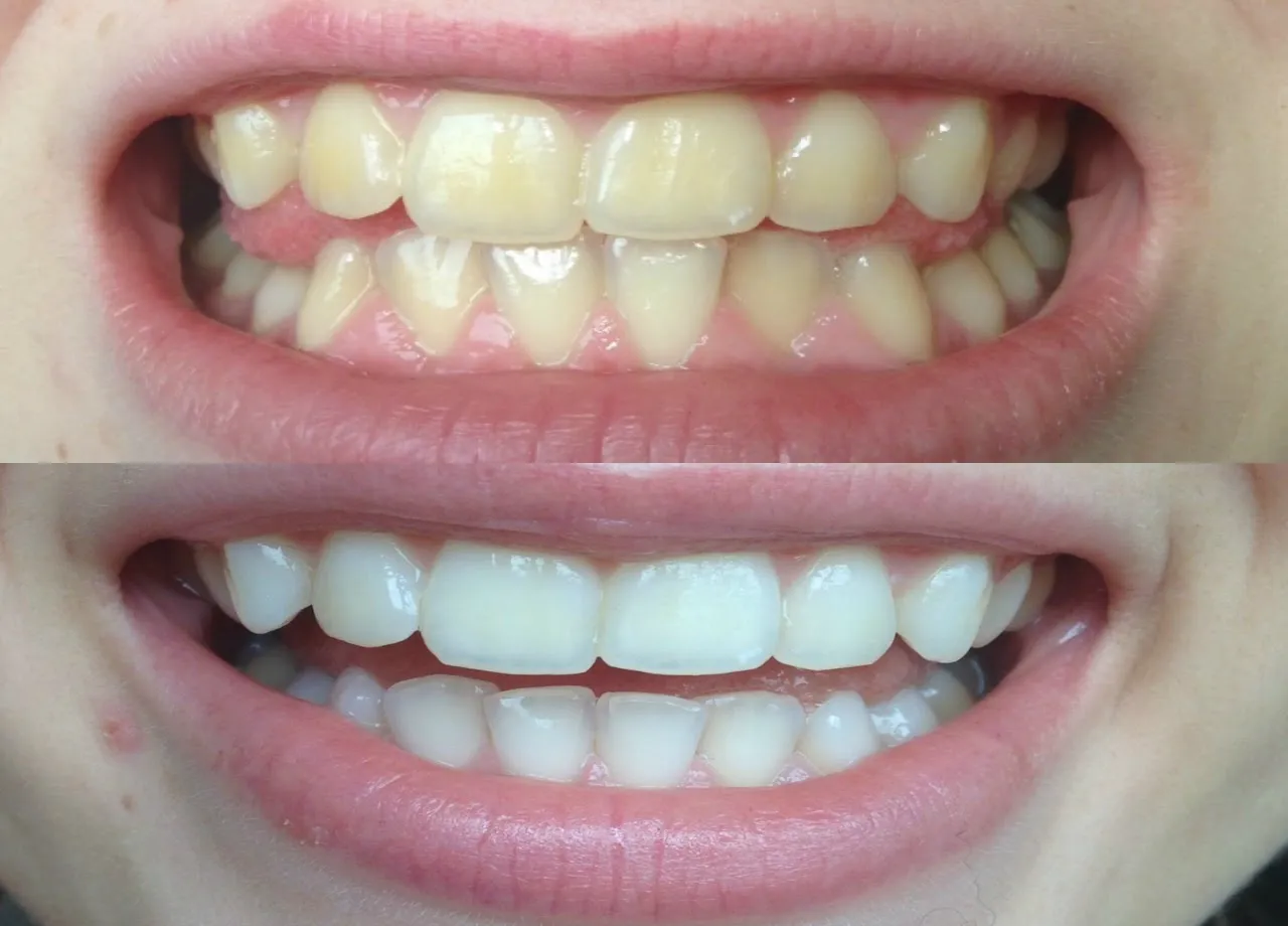/img/25284-dental-checkup.webp
