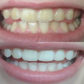 /img/25284-dental-checkup.webp