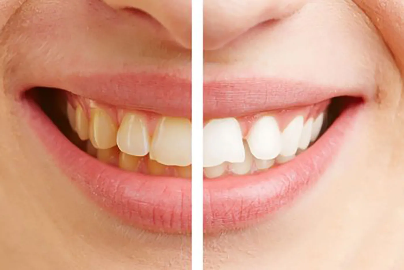25284 flossing teeth