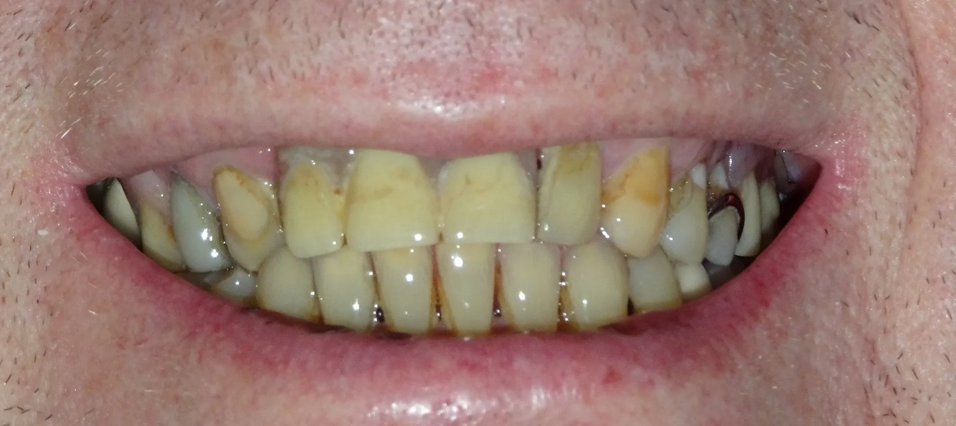 25284 whitening products