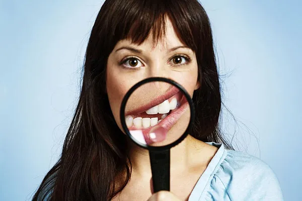25284 yellow teeth after whitening