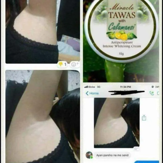 25286 comparing whitening products