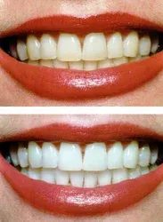 25297 vadodara dentist