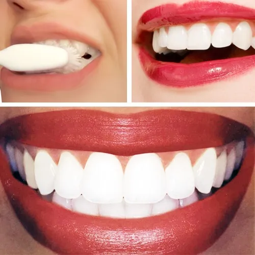 25298 strawberry teeth whitening image3