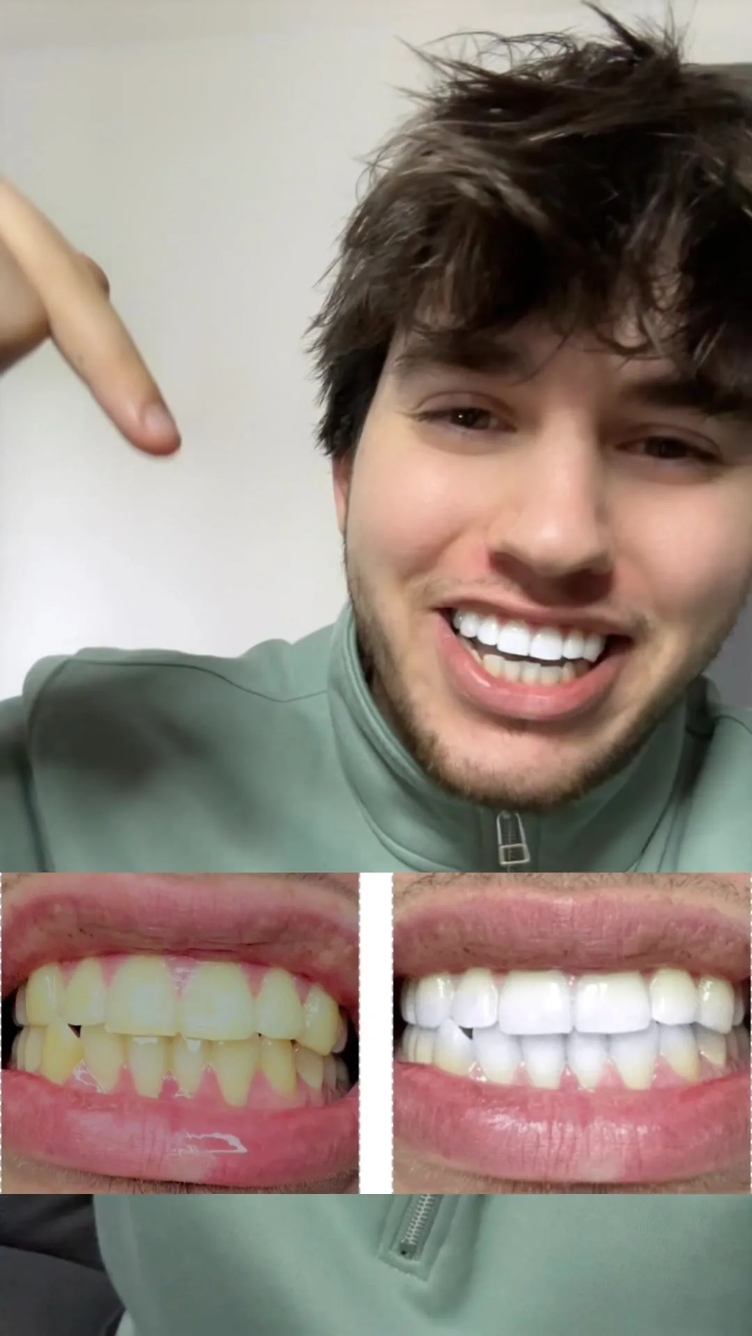 25298 strawberry teeth whitening image5
